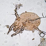 Psoroptidae