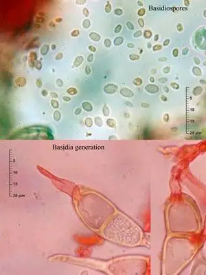 Germinación de un basidio de Puccinia annularis