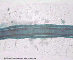 Detalle de la cola de la larva de un ascidiáceo