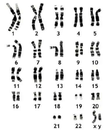 La Cromatina Y Los Cromosomas El Cariotipo
