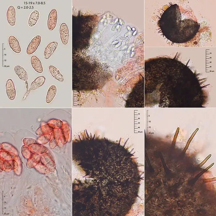 Epibryon bryophilum (Fuckel) Döbbeler <small>(3 de 3)</small>