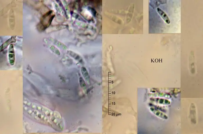 Lichenopeltella pinophylla (Höhn.) P.M. Kirk & Minter <small>(1 de 3)</small>