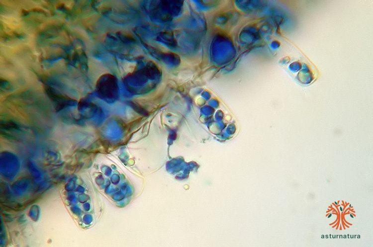 Taphrina deformans <small>(1 de 2)</small>