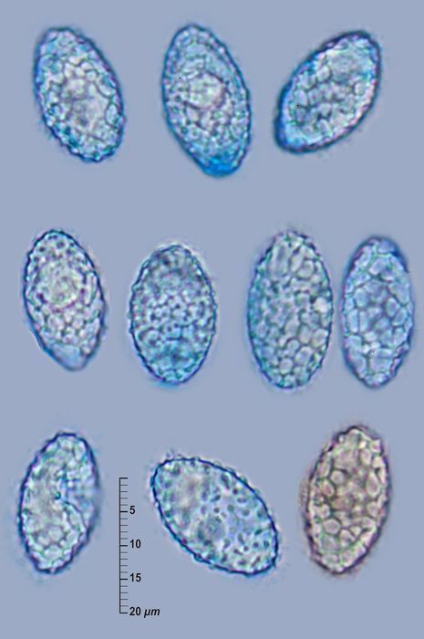 Neottiella albocincta (Berk. & M.A. Curtis) Sacc. <small>(2 de 3)</small>