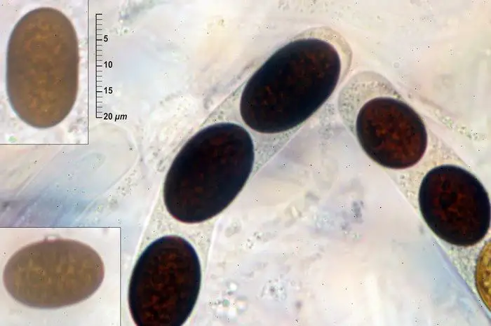 Amphisphaerella xylostei (Pers.) Rulamort <small>(1 de 3)</small>