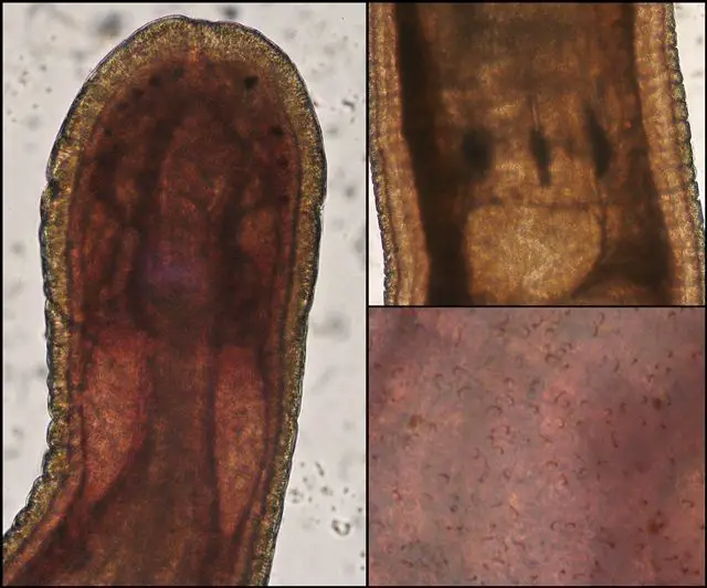 Emplectonema echinoderma <small>(1 de 2)</small>
