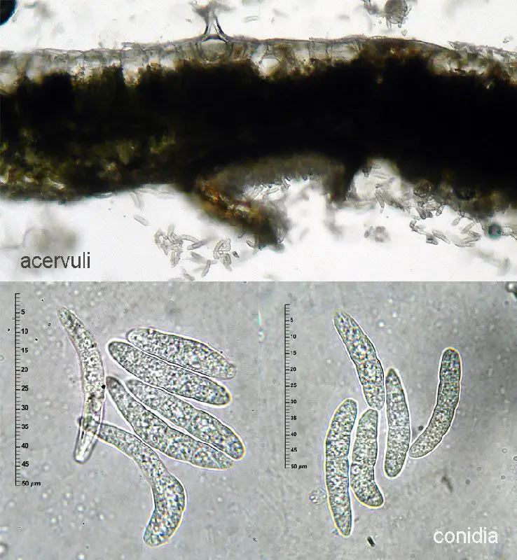 Mycosphaerella ulmi Kleb. <small>(1 de 2)</small>