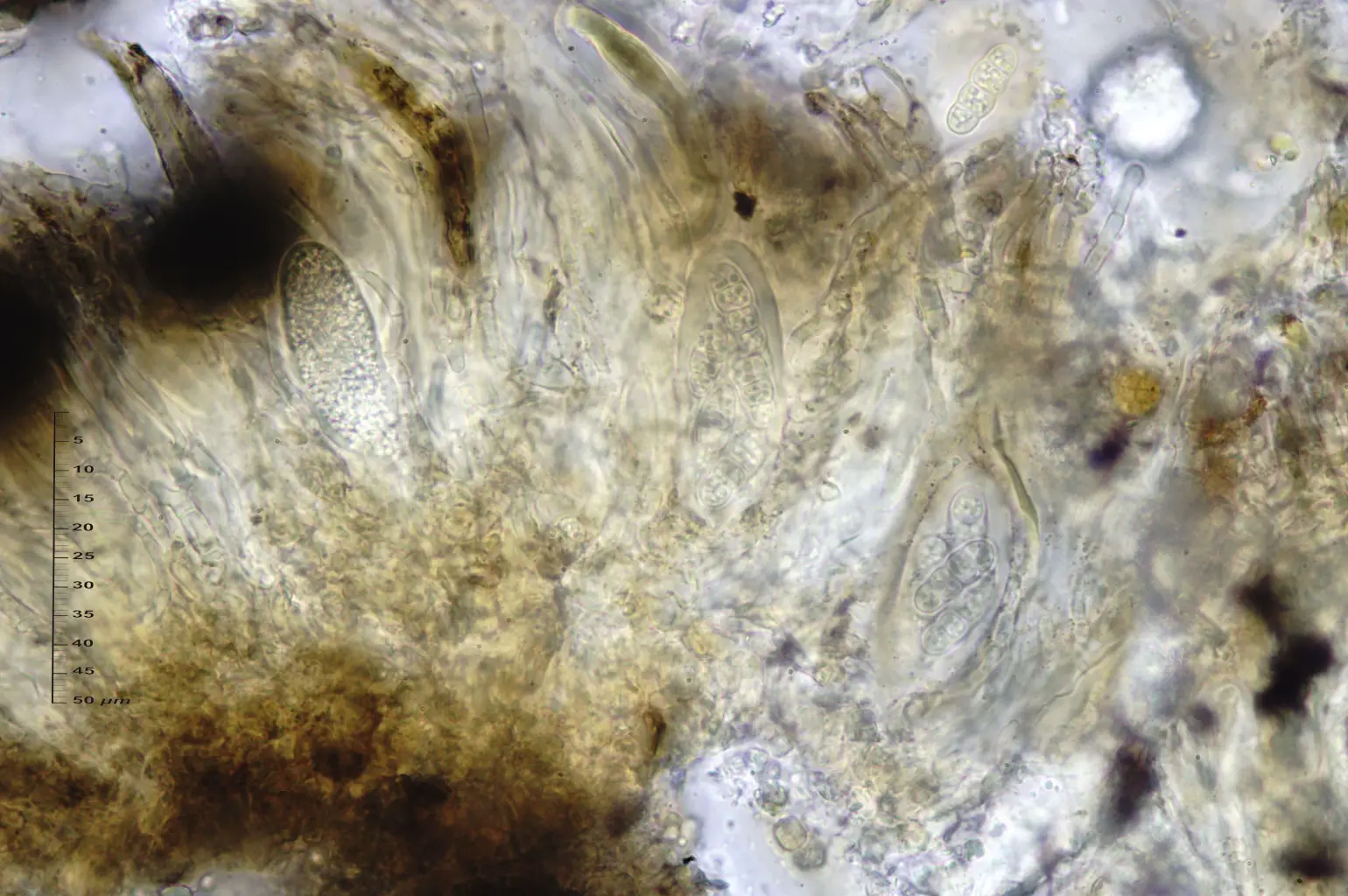 Arthonia calcarea (Turner ex Sm.) Ertz & Diederich (6 de 6)