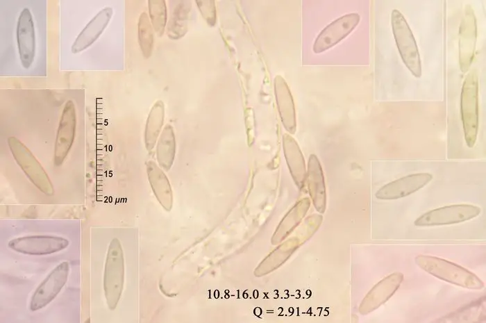 Phomatospora dinemasporium J. Webster <small>(2 de 3)</small>