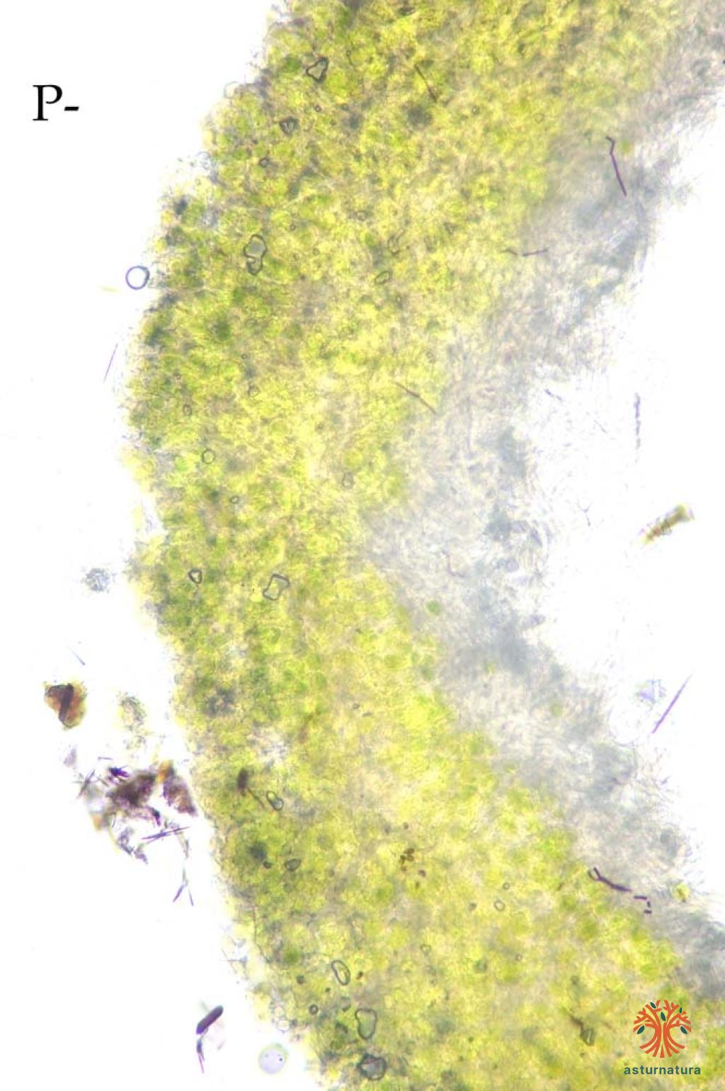 Hypogymnia tubulosa (Schaer.) Hav. (4 de 4)