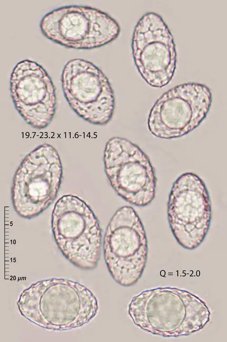 Neottiella albocincta (Berk. & M.A. Curtis) Sacc. <small>(3 de 3)</small>