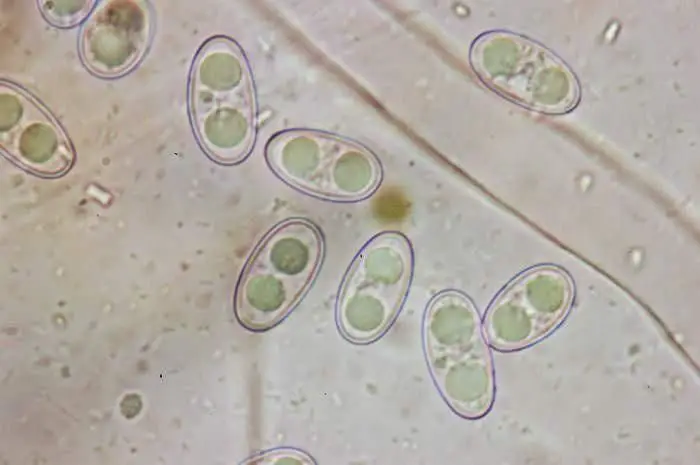 Anthracobia macrocystis (Cooke) Boud. <small>(3 de 3)</small>