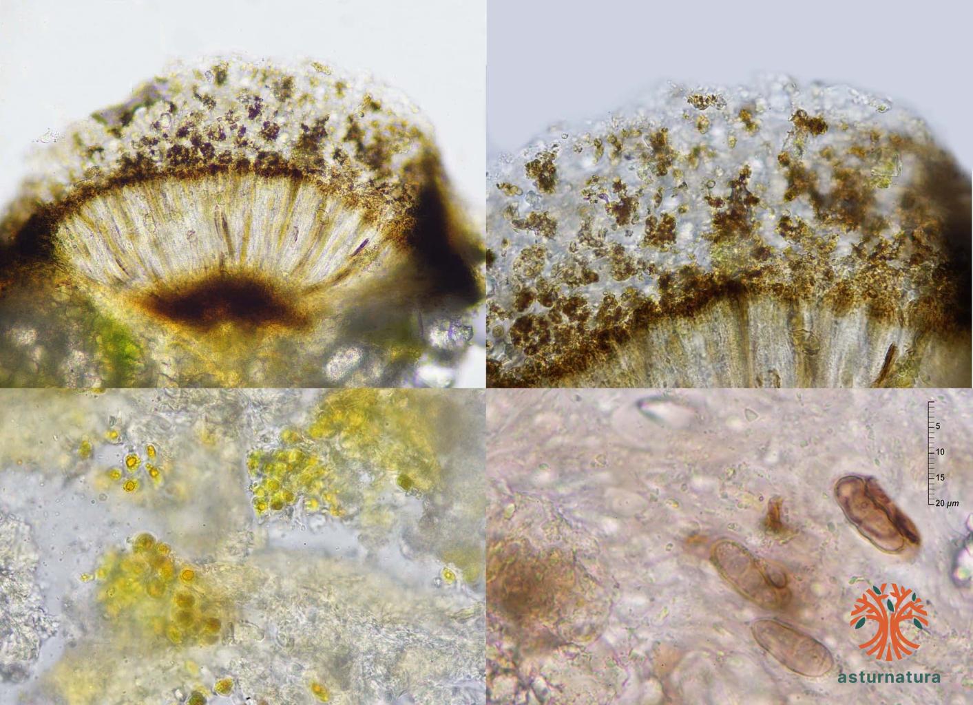 Phaeographis inusta (Ach.) Müll. Arg. <small>(3 de 3)</small>