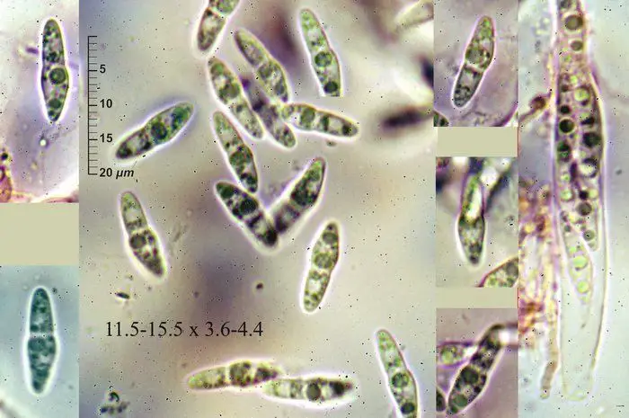 Microthyrium versicolor (Desm.) Höhn. <small>(1 de 3)</small>