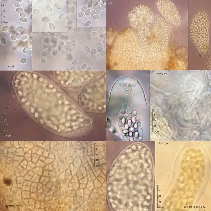 Thelebolus polysporus (P. Karst.) Otani & Kanzawa <small>(2 de 3)</small>