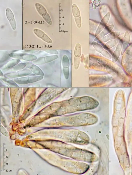 Mycosphaerella superflua (Fuckel) Petr. <small>(2 de 3)</small>