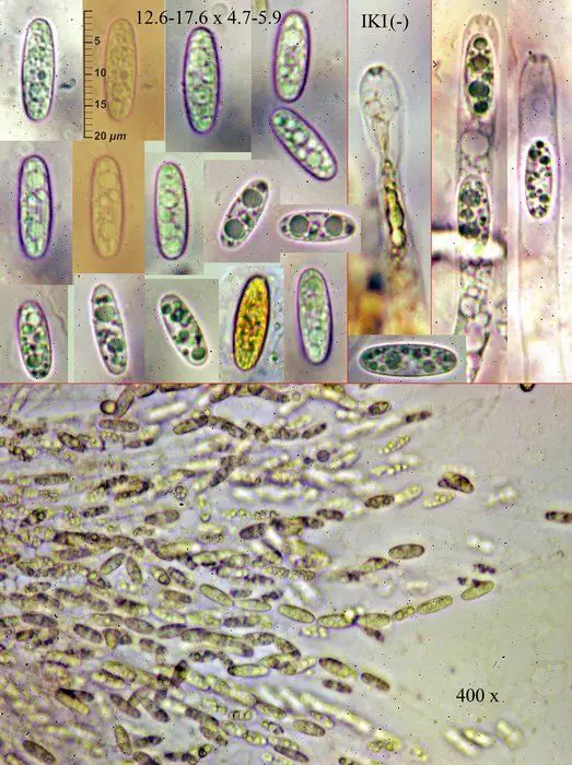 Phomatospora luteotingens J. Fourn. & C. Lechat <small>(3 de 3)</small>