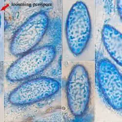 Scutellinia mirabilis Dissing & Sivertsen (1 de 3)