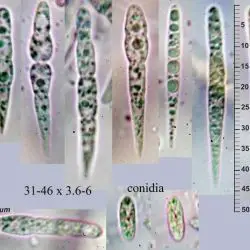 Godronia ribis (Fr.) Seaver (2 de 3) 