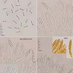 Chlorociboria lamellicola Huhtinen & Döbbeler (2 de 3)