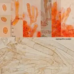 Lichenomphalia velutina (Qul.) Redhead, Lutzoni, Moncalvo & Vilgalys (3 de 3)