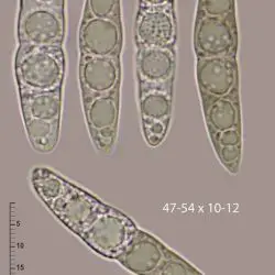 Lindgomyces griseosporus Y. Zhang ter, J. Fourn. & K.D. Hyde (2 de 3)