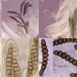 Sporormiella corynespora (Niessl) S.I. Ahmed & Cain (2 de 2)