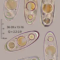 Octosporella jungermanniarum (P. Crouan & H. Crouan) Döbbeler (2 de 3)