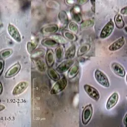 Leucoagaricus sericifer fo. sericatellus (Malenon) Vellinga (1 de 3)