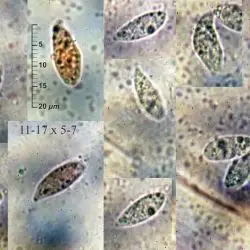 Fotografía Macrotyphula fistulosa (Fr..) R. H. Petersen (2 de 3)