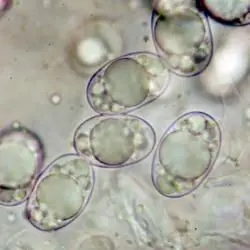 Balsamia polysperma Vittad. (2 de 3) 