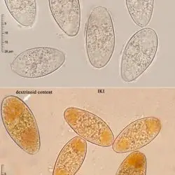 Octosporopsis nicolai (Maire) U. Lindemann, M. Vega & T. Richter (3 de 3)