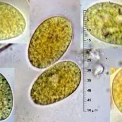 Phyllactinia fraxini (DC.) Fuss (2 de 3) 