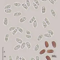 Leucoagaricus brunneocingulatus (P. D. Orton) Bon (2 de 3)