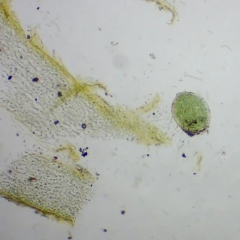 Nostoc commune (2 de 4)