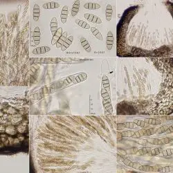 Plenodomus libanotidis (Fuckel) Gruyter, Aveskamp & Verkley (3 de 3)