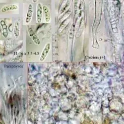 Claussenomyces prasinulus (P. Karst.) Korf & Abawi (2 de 2) 