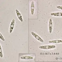 Calycellina pseudopuberula (Graddon) Baral (1 de 3)