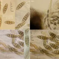Pleospora vitalbae (De Not.) Berl. (2 de 3)