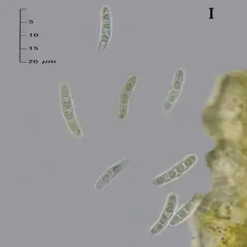 Pseudoschismatomma rufescens (Pers.) Ertz & Tehler (4 de 6)