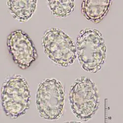 Scutellinia pennsylvanica (Seaver) Denison (2 de 3)