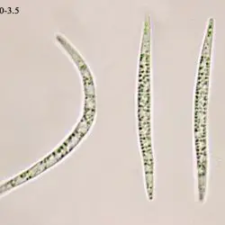 Acanthostigma scopulum (Cooke & Peck) Peck (2 de 3)