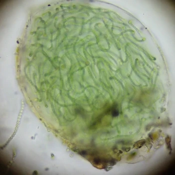 Nostoc commune (3 de 4)