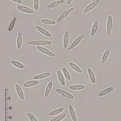 Lachnum brevipilosum Baral (2 de 3)