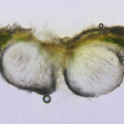 Pertusaria leioplaca (Ach.) DC (3 de 3)