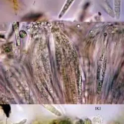 Fotografía Mellitiosporium pteridinum (W. Phillips & Buckn.) Sacc. (3 de 3)