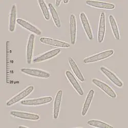 Cenangiopsis chlorospleniella (Rehm) Dennis (2 de 3)