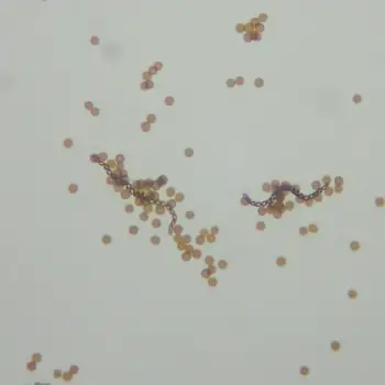 Lophocolea bidentata (4 de 6)