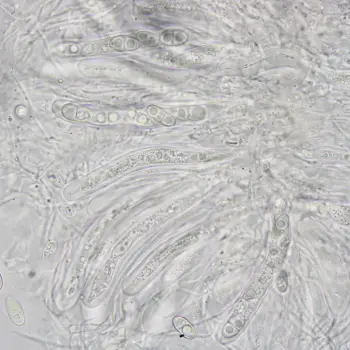 Anisomeridium polypori (Ellis & Everh.) M.E. Barr (5 de 5)