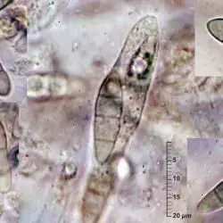 Gibberella cyanogena (Desm.) Sacc. (1 de 3)